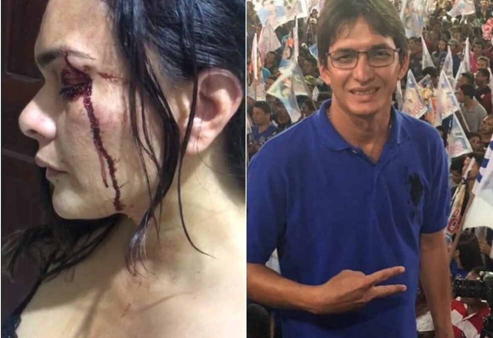 Ex-candidato a prefeito de Matinha é suspeito de agredir a ex-mulher: “ele não aceitou a separação”